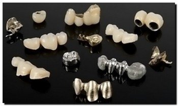 Зубные мосты из металокерамики