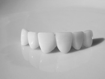 Керамические коронки на передние зубы