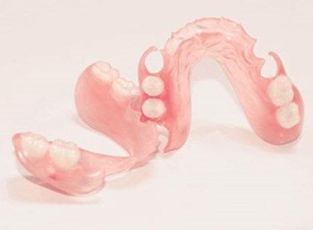 Нейлоновые протезы при частичном отсутствии зубов