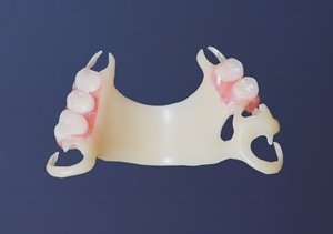 Зубные протезы квадротти